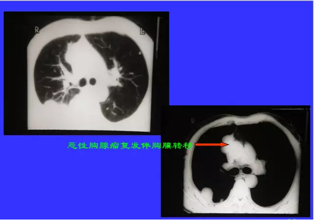 盘泰最新CT技术引领医学影像新时代